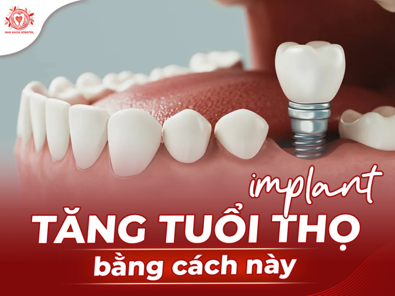 tang-tuoi-tho-implant