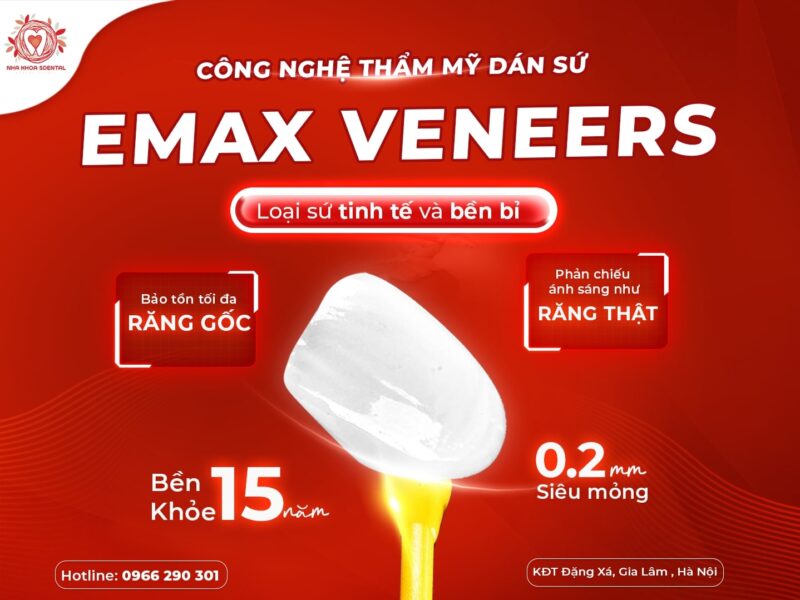 Răng sứ emax
