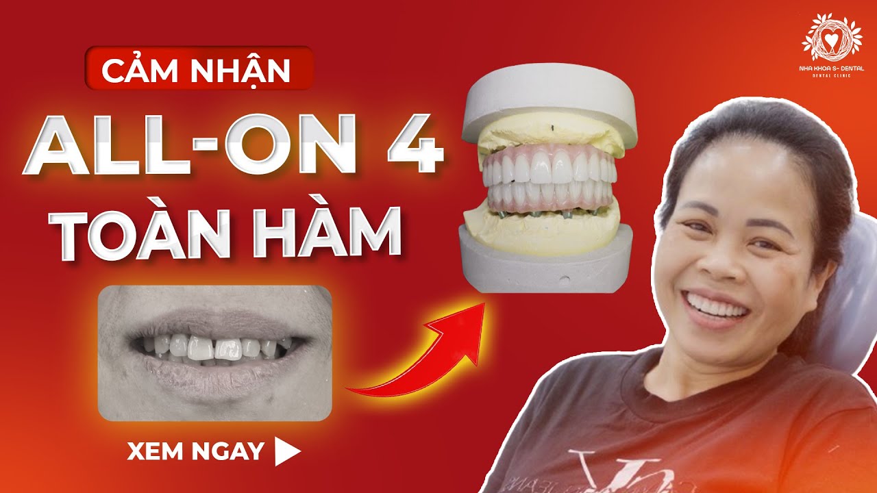 Dịch vụ nha khoa uy tín ở Gia Lâm